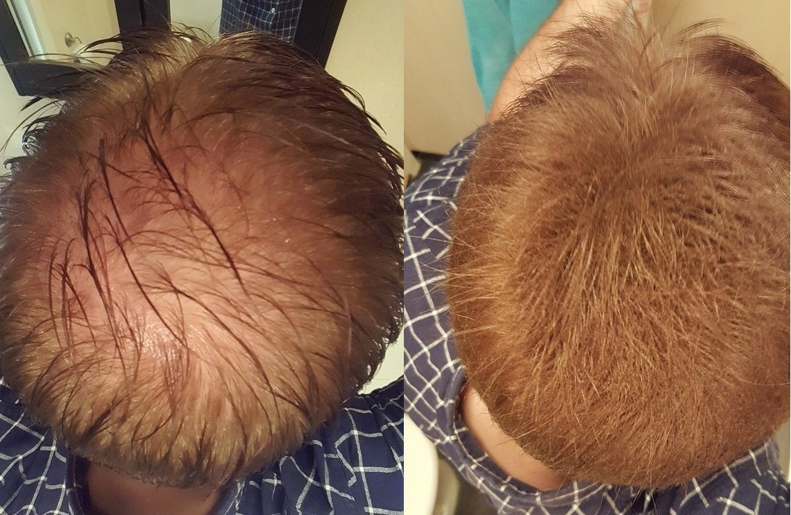 Våre kunder før og etter bilder