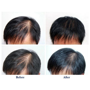 6x60ml = 360ml - Kirkland Hair Regrowth Treatment Extra Strength serum til mænd - 60ml
