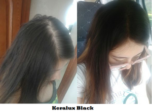 Keralux Large - Black - Black